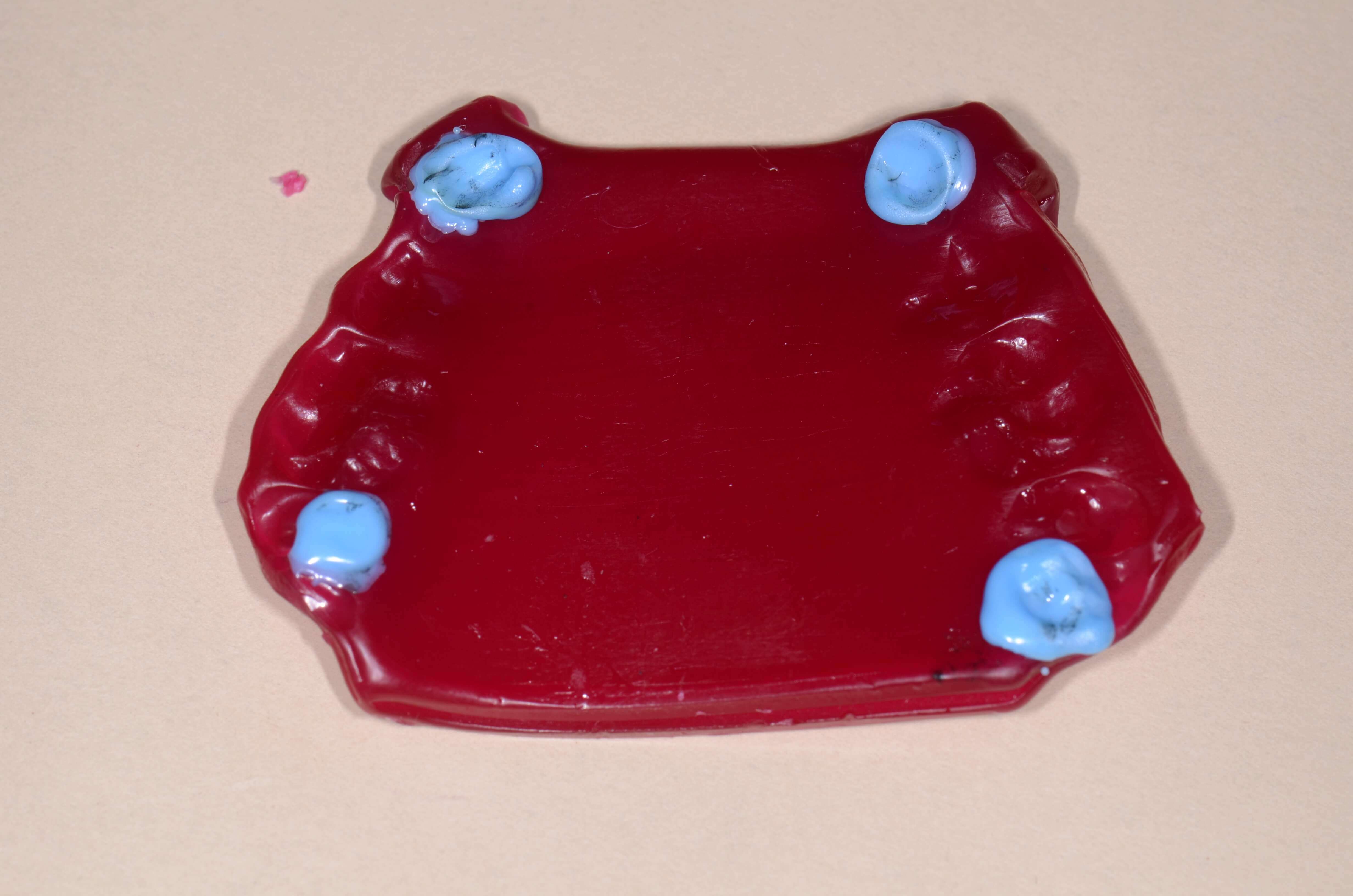 Taking A Master Wax Centric Relation Bite Record Restorative Nation