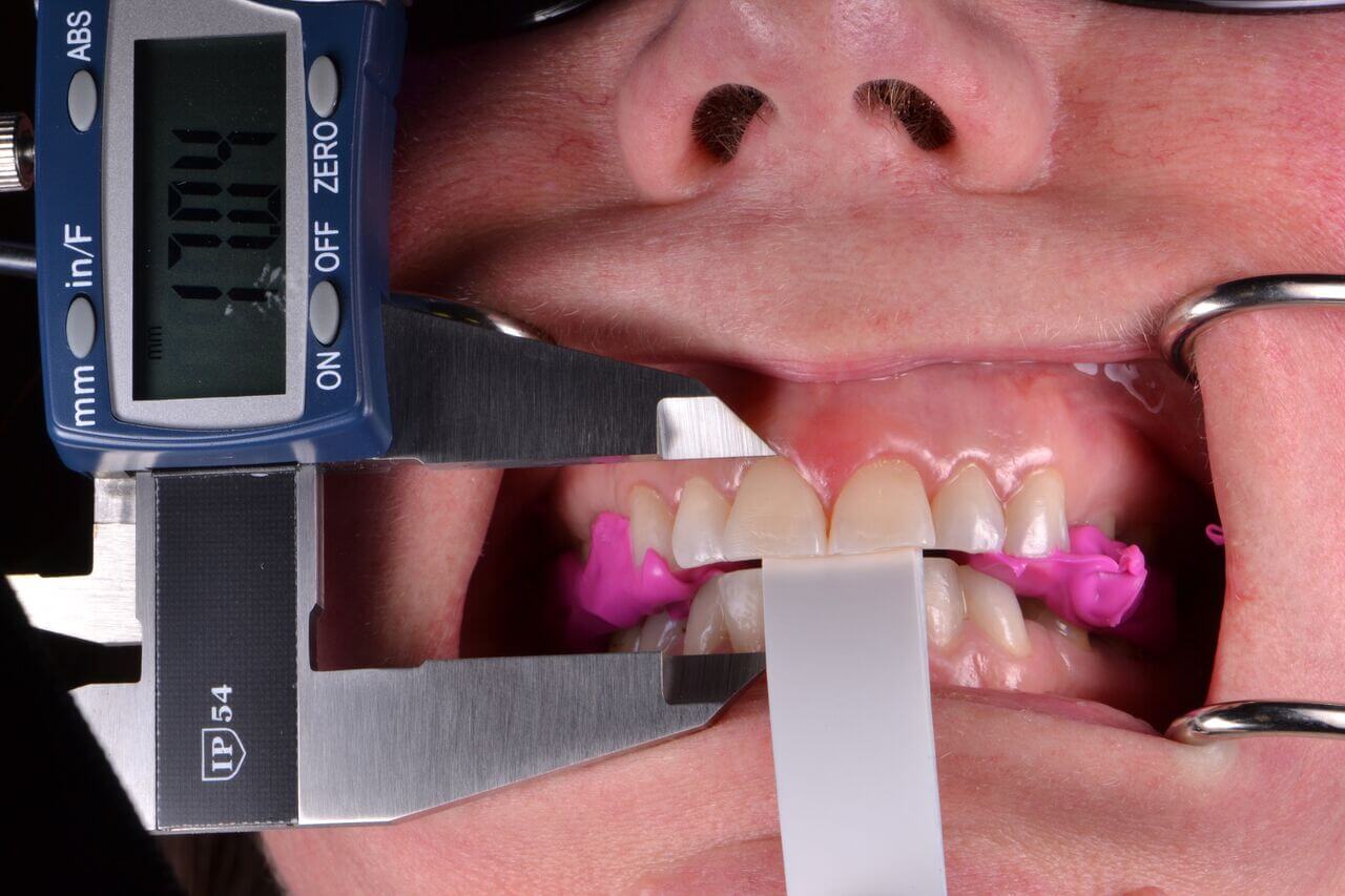 VDO Lab Communication Restorative Nation